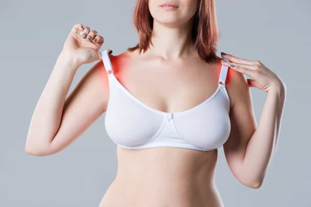 A woman with irritated skin under her bra straps.